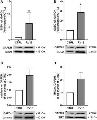 Oxidative Stress Attenuates TLR3 Responsiveness and Impairs Anti-viral Mechanisms in Bronchial Epithelial Cells From COPD and Asthma Patients